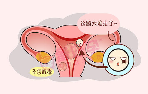 子宫肌瘤对女性具体有多少危害